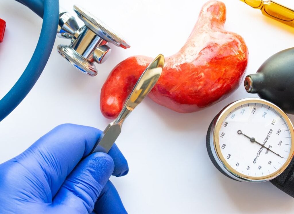 Slider Foods To Avoid After Gastric Bypass The Instant Pot Table slider-foods-to-avoid-after-gastric-bypass-the-instant-pot-table